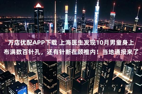 万店优配APP下载 上海医生发现10月男童身上布满数百针孔，还有针断在颈椎内！当地通报来了